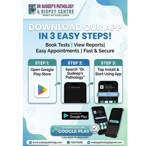 mobile-app